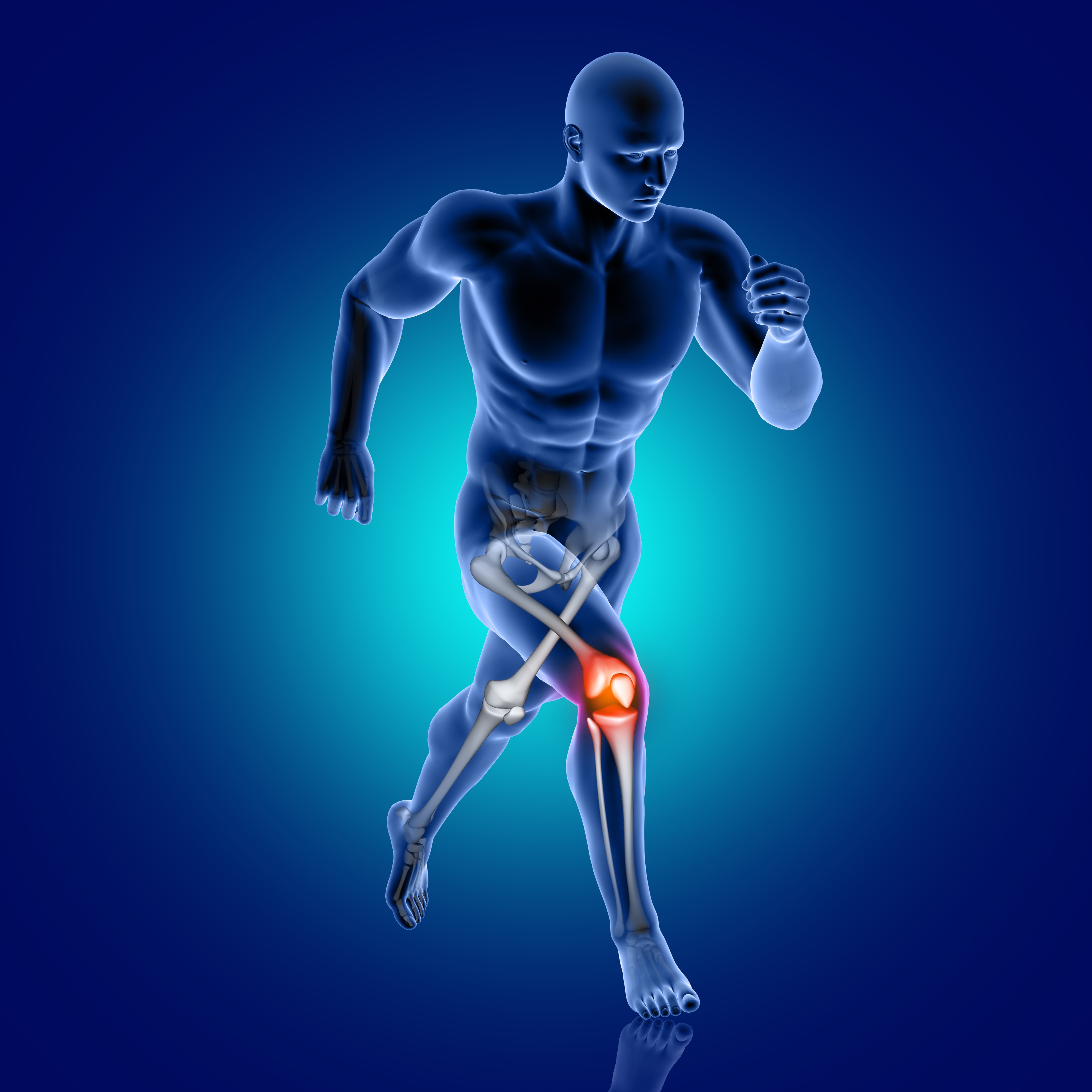 Physiotherapy for arthritis management, featuring a blog image related to enhancing quality of life through physical therapy.