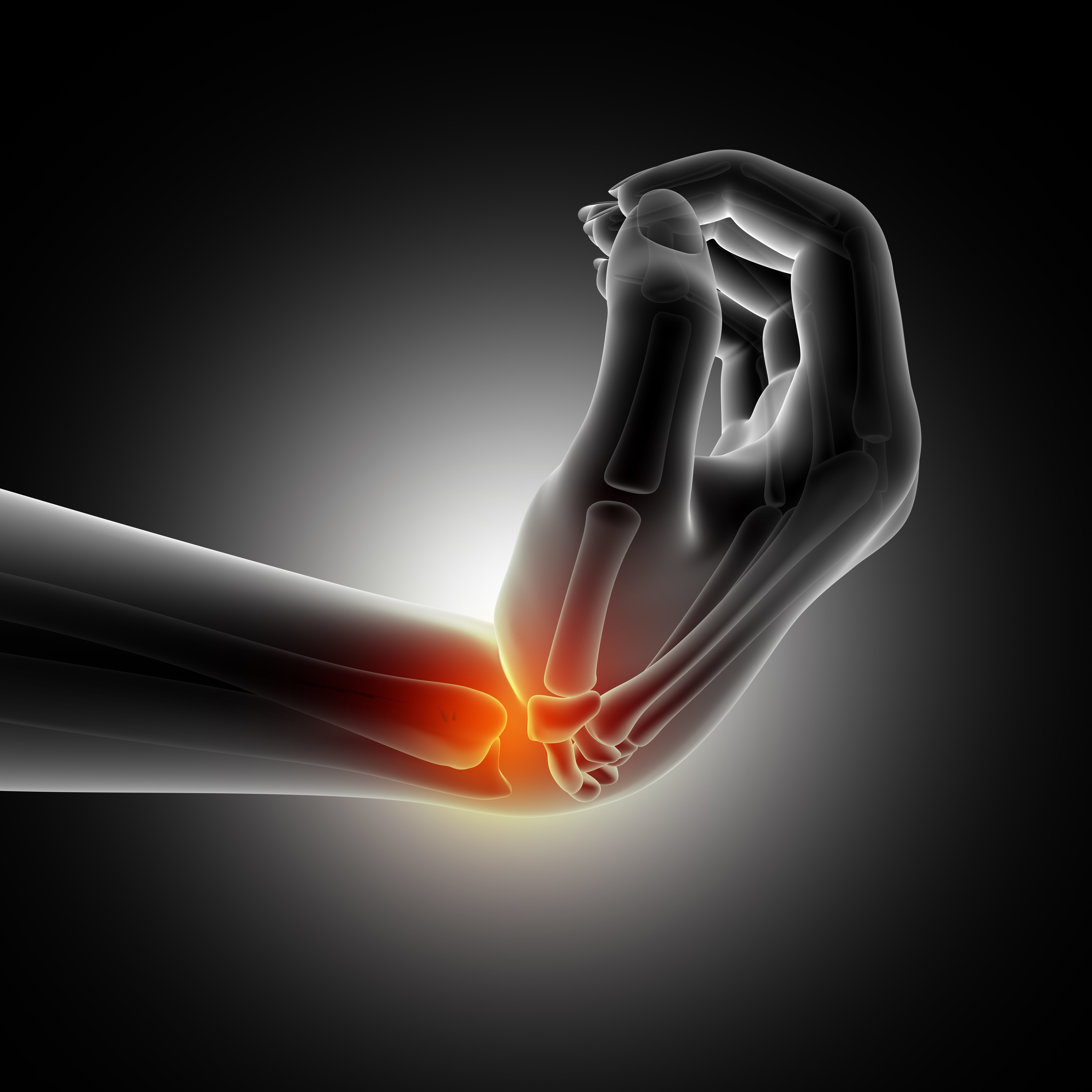 Recovery from fractures and sprains through physiotherapy, depicting methods to enhance recovery and rehabilitation.